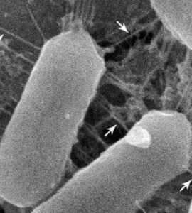 These bacteria have adapted to life in your nose—and that may be good news | Science