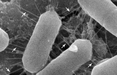 These bacteria have adapted to life in your nose—and that may be good news | Science